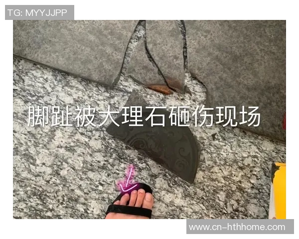 加兰左脚大脚趾再度受伤复查结果将影响未来比赛安排 加兰左脚大脚趾再度受伤复查结果将影响未来比赛安排